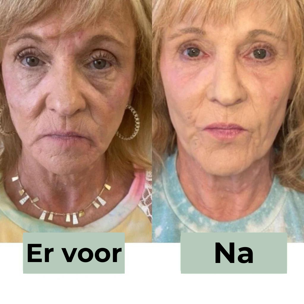 CËLYN CREAM™ | Anti-puffighetskräm