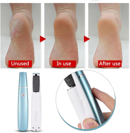 CallusGrinder 1+1 GRATIS - Elektrisk Fot Kvarn Kallus Avlägsnare
