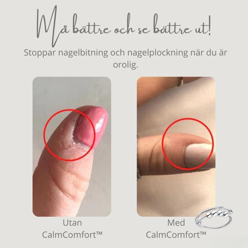 CalmComfort™ - Justerbar pärl-ring | 1+1 GRATIS TILLFÄLLIGT
