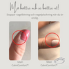CalmComfort™ - Justerbar pärl-ring | 1+1 GRATIS TILLFÄLLIGT