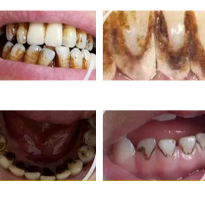 DentalCare – Lätt 360° Tandvård Verktygsset Hemma